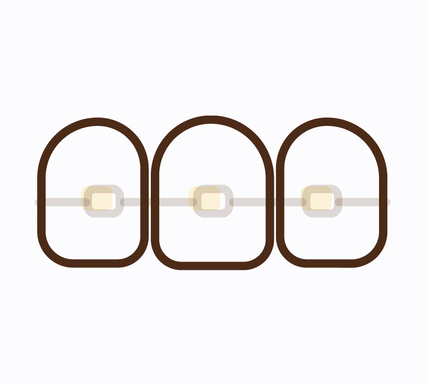 Braces & Orthodontics