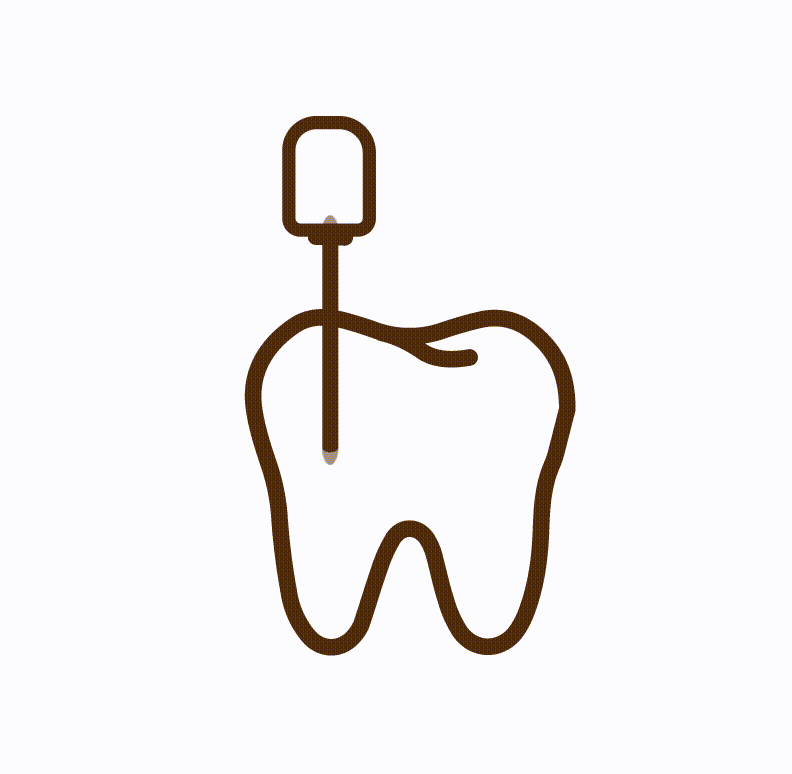 Root Canal Treatment